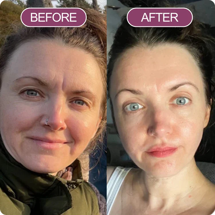 Dr. Melaxin Lift Balm