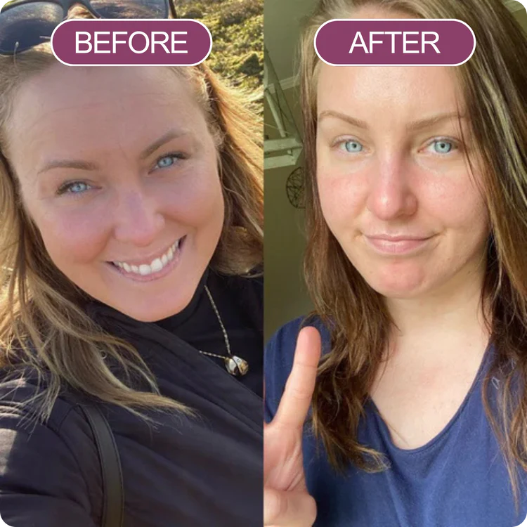 Dr. Melaxin Lift Balm