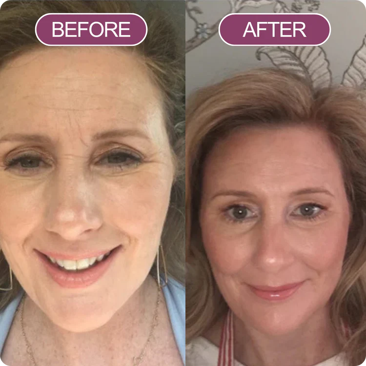 Dr. Melaxin Lift Balm