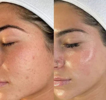 Peel Shot Rice Ampoule Duo